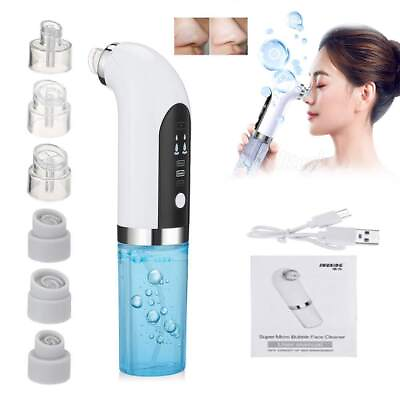 Blackhead Remover Facial Pore Cleaner Water Circulation Portable Vacuum Tool